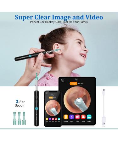 Ear Wax Removal Ear Cleaner Tool With Camera 1080P FHD Wireless Wifi Ear Otoscope with 6 LED Lights 3.5mm Waterproof Endoscope for iPhone iPad & Android Smart Phone Suitable for Kids Adults Pets - Buy Online on GoSupps.com