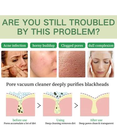 Green Tomato Clay Mask - Green Tomato Face Cleanser - Clean and Clear Cleanser - Face Wash for Dry Skin & Acne Prone Skin - Deep Pore Cleansing Hydrating & Moisturizing - Buy Online on GoSupps.com