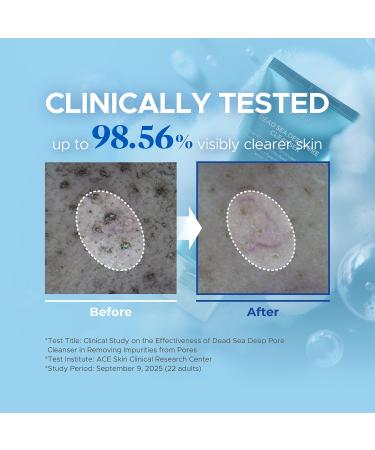 it:fu Deep Pore 2-in-1 Exfoliating Cleanser | Korean Hydrating Face Cleanser | Fungal & Hormonal Acne Support | Enzyme & Dead Sea Mud Formula (4.23 fl. oz) - Buy Online on GoSupps.com