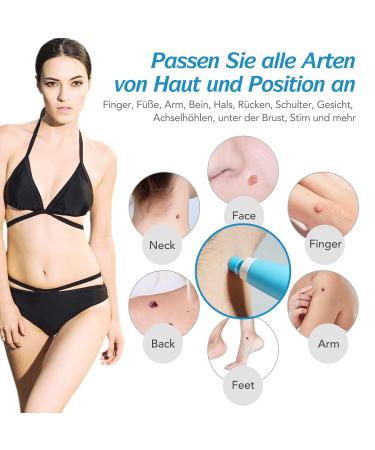 Skin Day Distant Car Skin Tag Remover Kit | Safe & Painless 2-in-1 Wart Removal | 20 Large & 20 Small Patches for 2-8 mm Tags - Buy Online on GoSupps.com