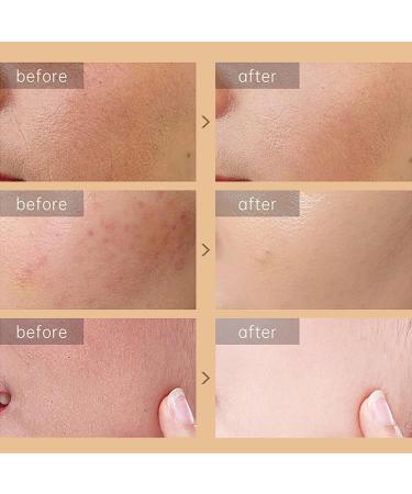 Snail Repair Cream | Hydrating Snail Moisturizer with Snail Secretion Filtrate for Dry Skin | Reduce Fine Lines & Repair Damage - Buy Online on GoSupps.com