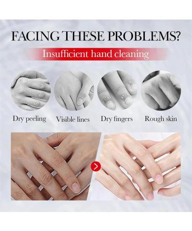 JUFKGBAR Kojic Acid Hand Cream Kojic Acid Cream Hyaluronic Acid Niacinamide Tender Cream Anti-Wrinkle Firming Hand Cream Moisturizing and Nourishing - Buy Online on GoSupps.com