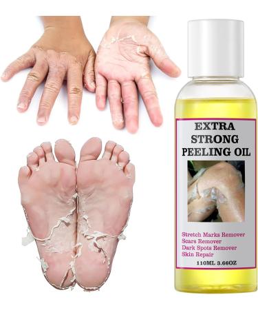 Exfoliating Yellow Peeling Oil for Extra Strength Exfoliation Exfoliating Peeling Solution for Body and Face Skin Peeling Chemical Peel at Home - Buy Online on GoSupps.com