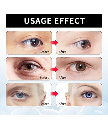 Binozity Skin Tightener Binozity Temporary Face Tightener Instant Firm Face Temporary Eye Tightener Binozity Under Eye Cream Binozity Eye Cream Improves Puffiness And Puffy Eyes (2) - Buy Online on GoSupps.com