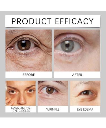 Nourishing Eye Cream Revitalizing Eye Cream Eye Firming Treatments Hydrating Eye Cream Anti Agings and Tightening Firming Eye Cream Perfect and Suitable for Adults - Buy Online on GoSupps.com