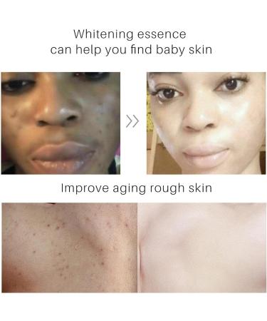 Voiakiu Turmeric Body Cream - Skin Whitening Cream 100 ml for Adults - Skin Friendly Body Moisturizer for Men Body Skin Care Product - Buy Online on GoSupps.com