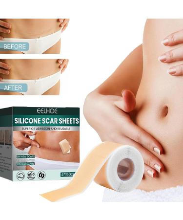 Teksome Silicone Scar Sheets - Stretch Mark Remover | Soften & Flatten Scars | For Surgery Injury Burns C-Section | 1.57*59 Inches - Buy Online on GoSupps.com