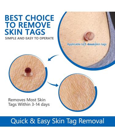 Kit de Acrochordons Skin Tag Remover avec 60 Bandes d' tiquettes Cutan es Micro et R guli res (1 mm 9 mm) pour le visage et le corps avec 36 patchs de r paration - Buy Online on GoSupps.com