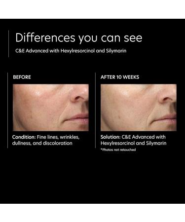 PCA SKIN C&E Advanced - Antioxidant Corrective Face Serum with Vitamins C&E for Anti-Aging / Dark Spots (1 oz) C&E Advanced Serum (1 Ounce) + Hyaluronic Acid Boosting Serum (1 Ounce) - Buy Online on GoSupps.com