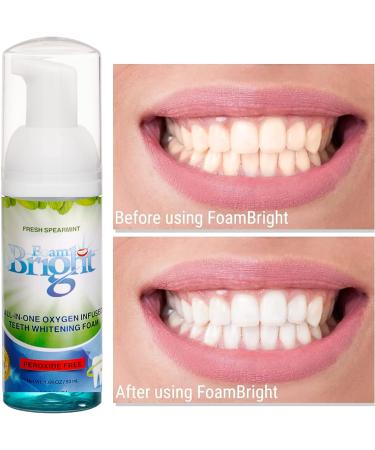 Retainer & Aligner Cleaner Foam - Ideal for Invisalign, Teeth Whitening, and Braces - Peroxide-Free Oral Care Foam - Buy Online on GoSupps.com