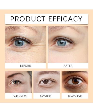  Dyceittdia Eye Cream1 - Buy Online on GoSupps.com