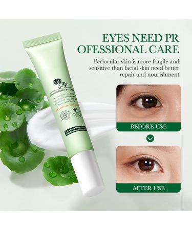  Utapossin Eye contour cream eye contour with Centella Asiatica extract fine lines eye cream visibly reduces puffiness and dark circles - Anti-wrinkle and anti-aging moisturizing eyes and - Buy Online on GoSupps.com