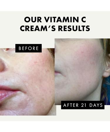 Buy Vitamin C Face Cream - Brightening Moisturizer with 2.5% Hyaluronic Acid & 2% Squalane for Uneven Skin Tone & Wrinkles - Antioxidant Firming Cream International Shipping Available - Buy Online on GoSupps.com