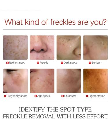 Pigment Correcting Cream Pigment Correcting Brightening Cream Anti-Pigment Pigment Correcting Cream Dark Spot Corrector Daily Face Serum Brightening Face Moisturizer For Melasma Spot - Buy Online on GoSupps.com