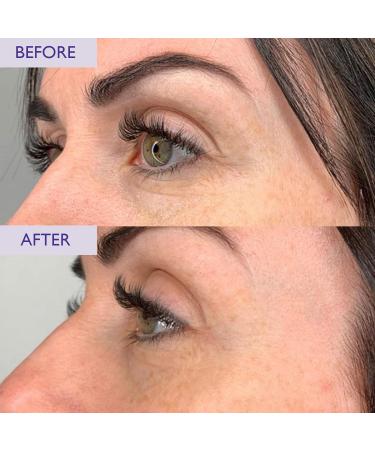 SKINICIAN Ageless Peptide Eye Complex - Anti-Wrinkle Eye Cream with Hyaluronic Acid & Vitamin C - Peptide Serum Eye Cream for Dark Circles - Stimulate Collagen Product - Vegan & Cruelty Free (15ml) - Buy Online on GoSupps.com