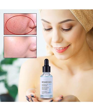 Moisturizing Essence Facial Essence for Dull SkinHyaluronic Acid Moisturizer Moisturizing Facial Essence for Women Pore Minimizer Reduce Excessive Oils Skuda - Buy Online on GoSupps.com