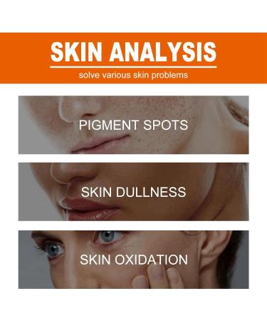 Aobenz Spot Remover for Face Dark Spot Remover for Face Anti Spot Serum Dark Spot Correcting Serum Skin Whitening Spot Treatment Freckle Remover Sun Spot Dark Spot Cream Brightening Serum 50ml - Buy Online on GoSupps.com