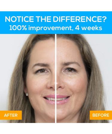 Beauty Star EP-2000 Microcurrent Face Lift Device - Med Spa Grade for Tightening Wrinkles, Lines, and Aging on Face, Chin, and Neck - Buy Online on GoSupps.com