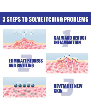 DENERASS South Moon Psoriasis Repair Spray - Herbal Relief Treatment for Skin (3pcs) - Buy Online on GoSupps.com