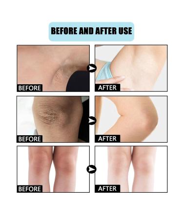 Whitening & Brightening Cream for Dark Skin | After Sun Bleaching for Neck Elbows & Inner Thighs - 1 PC - Buy Online on GoSupps.com