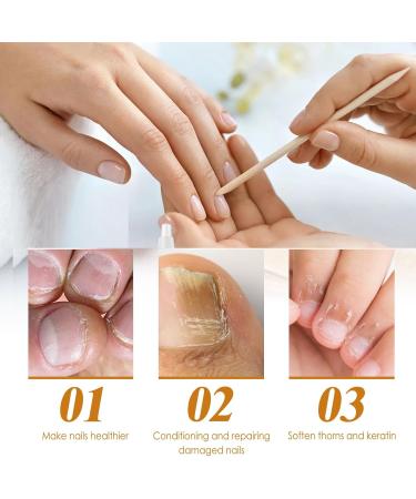 Cuticle Remover Cream Nail Cuticle Repair Gel Supremely Gentle Cuticle Remover Nail Treatments for Cuticle Softener Nail Cuticle Care Gel for Used to Repair Nail Damage & Moisturize Manicure 30ML - Buy Online on GoSupps.com