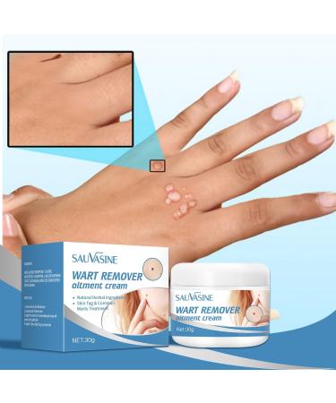 Wart Remover Cream Fast Acting Ointment Anti Corn Cream for Warts Plantar Warts Common Warts Flat Warts Warts for Feet Toe Finger Hands - Buy Online on GoSupps.com