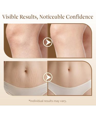 Magic Body Firming Oil After Shower Body Oils for Women with Massage Roller | Tighten, Hydrate, Crepe Erase, Anti Cellutite with DEFENSIL , Vitamin E & Natural Botanicals (5.07 fl.oz.) Camellia - Buy Online on GoSupps.com
