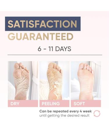 Exfoliating Peel Mask for Dry Hard Feet - Callus Remover - 2 Pack Large Size Socks - Foot Spa Treatment for Soft Healthy Feet - Buy Online on GoSupps.com