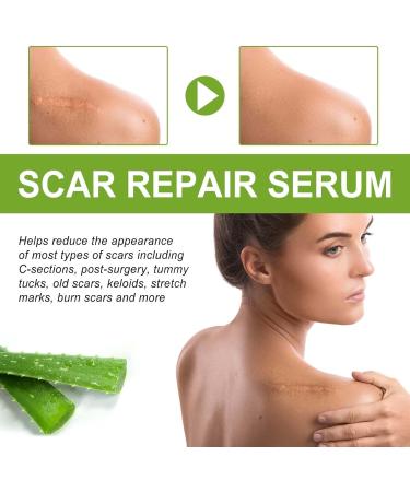 sjfscqr Natural Scar Repair Essence Medical Grade Scar Repair Serum Advanced Scar Repair Serum Suitable for All Types of Scars - Buy Online on GoSupps.com