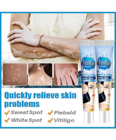 MIELIKKI Vitiligo Cream | Reduce White Spots & Enhance Skin Pigmentation | Natural Vitiligo Care Cream for All Skin Types - Buy Online on GoSupps.com