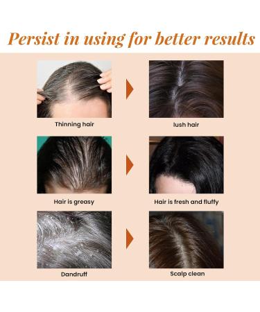  Nurvidis Horse Oil Shampoo Nourishing Horse Oil Shampoo Thickening Shampoo Hair Products Anti-Dandruff Shampoo Makes Hair Stronger and Thicker (2 - Buy Online on GoSupps.com