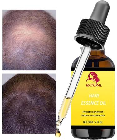 driattie Hair Growth Oil Natural Hair Essence Oil Hair Care Treatments with Concentrated Formula Natural Lightweight Nongreasy Hair Care Strengthens and Repairs Damage Before Use - Buy Online on GoSupps.com
