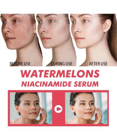 Skincare Set Skin Care Women Watermelon Niacinamide Skin Care Set For Teenage Girls - Watermelon Serum and Sleeping Mask - Deep Hydration Skin Care Sets & Kits - Buy Online on GoSupps.com
