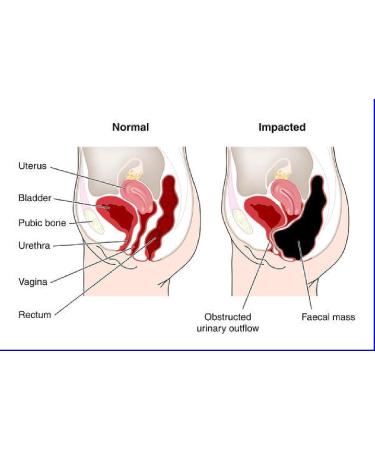 The One Minute Miracle Oxy-Colon Cleanse Vegan Colon Cleanser - 120 Vegatarian Capsules. - Buy Online on GoSupps.com