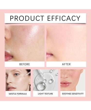 Face Serum - Gentle Daily Moisturizer For Brightening Skin Reduces Melanin Evens Tone & Strengthens Barrier(1PCS) 1 Fl Oz (Pack of 1) - Buy Online on GoSupps.com