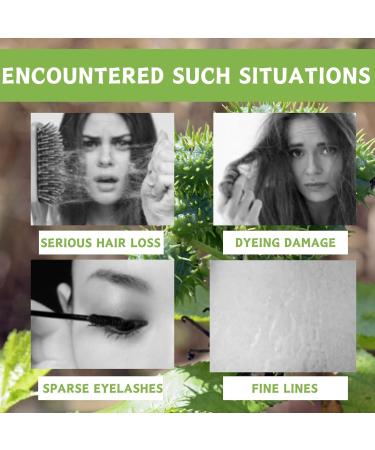 Cold Pressed Castor Oil - Organic Castor Oil - Veganic Hair Growth Oil for Eyelash Eyebrow Hair Growth Serum - Organic Castor Oil for Skin and Body - Moisturizing & Reducing Lines Castor Oil - Buy Online on GoSupps.com