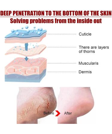 Adawd Foot Peeling Mask - Moisturizing Treatment Socks for Baby Soft Feet Removes Dead Skin & Repairs Cracked Heels - 1 Piece - Buy Online on GoSupps.com