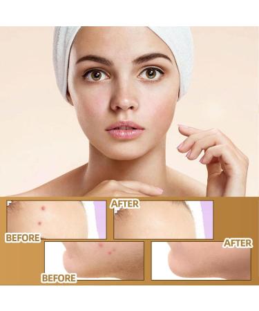 5 Breathable Skin Invisible Up Stickers Skin Scar Pimple Sticker | Waterproof Skin Tone Invisible Sticker Skin Concealing Patches 60 5 Pcs 60patch/Box - Buy Online on GoSupps.com