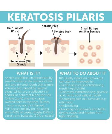 Keratosis Pilaris Treatment | Keratosis Pilaris Lotion with 10% AHA | Gentle Exfoliation For Strawberry Legs, KP & Ingrown Hairs | Smooth & Hydrating Body Lotion For Redness, Dry, Rough And Flaky Skin KP Lotion - Buy Online on GoSupps.com