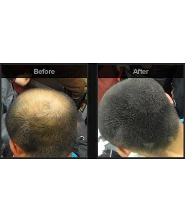Hair Building Fibers - Light Brown Hair Loss Concealer | Thinning Hair & Volume Boost for Men & Women | 12 Day Supply - Buy Online on GoSupps.com