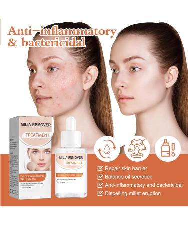Fat Granule Clearing Skin Essence Milia Clearing Essence Milia Remover Serum Organic Skin Spot Purifying Serum Milia Spot Removal Treatment Helps Dissolve and Reduce Milia - Buy Online on GoSupps.com