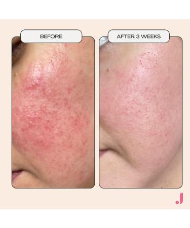 Jess Beauty Post Workout Gel Mask - 1.7 fl oz with Niacinamide & Centella Asiatica - Buy Online on GoSupps.com