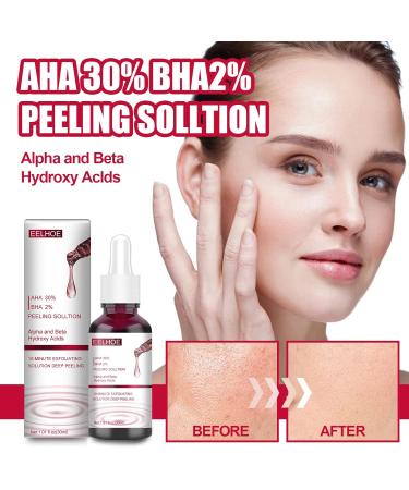AHA 30% + BHA 2% Peeling Solution - Exfoliating Serum for Blemishes Pore Congestion & Fine Lines | 30ml International Shipping - Buy Online on GoSupps.com