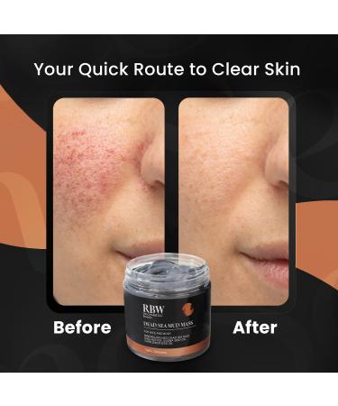 RBW Dead Sea Mud Mask - Natural Facial Treatment for Deep Cleansing & Hydration - Organic Spa-Quality Care for Glowing Skin - Buy Online on GoSupps.com