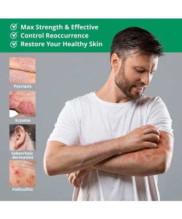 Psoriasis Eczema Cream - Maximum Strength Relief for Resistant Symptoms | 100ml - Buy Online on GoSupps.com