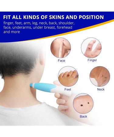 GIMOCOOL Auto Skin Tag Remover kit Skin Tag Treatment Anti-skin Tag Pen Skin Wart Removal Device 2-8mm 2 in 1 for Removing Face Body Warts - Buy Online on GoSupps.com