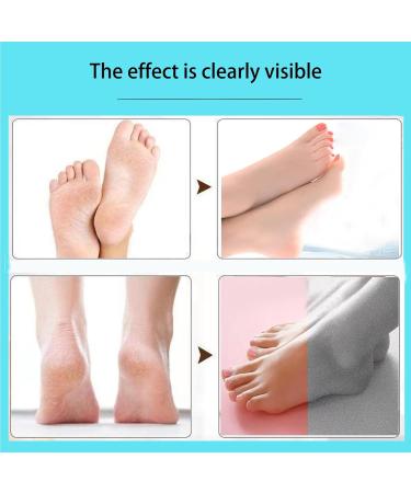 Smooth Pedicure Wand - Electric Rechargeable Callus Remover & Foot Care Kit for Smoother Feet - Buy Online on GoSupps.com