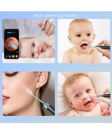2MP 1080p Ear Wax Removal Camera - 360 View 6 LED Lights Safe & Hygienic Inspection for Ear Nose Mouth - Smartphone Connectivity - Buy Online on GoSupps.com