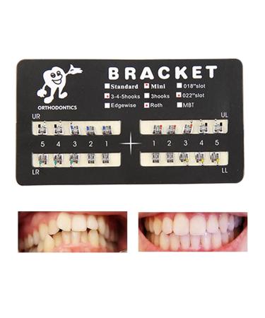 Dental Slot Bondable Brackets Teeth Model Braces Roth Brackets Roth 022 (100 Pcs) - Buy Online on GoSupps.com