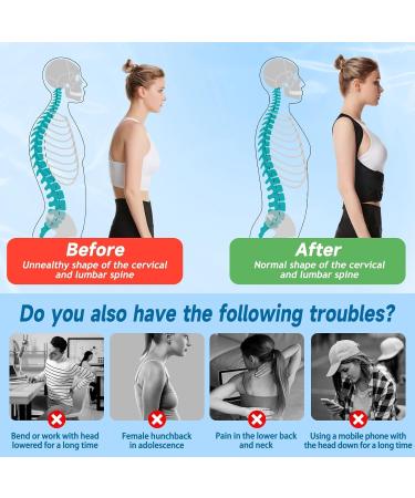 Yizemay Posture Corrector | Adjustable Back Support for Men & Women | Breathable Shoulder Strap | XL Size - Buy Online on GoSupps.com